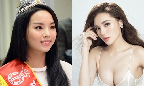 Loạt Hoa hậu, Á hậu vướng ồn ào phẫu thuật thẩm mỹ, “lột xác” sau đăng quang - Ảnh 4.