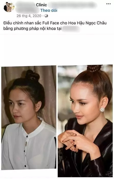 Loạt Hoa hậu, Á hậu phẫu thuật thẩm mỹ, “lột xác” sau đăng quang - Ảnh 4.