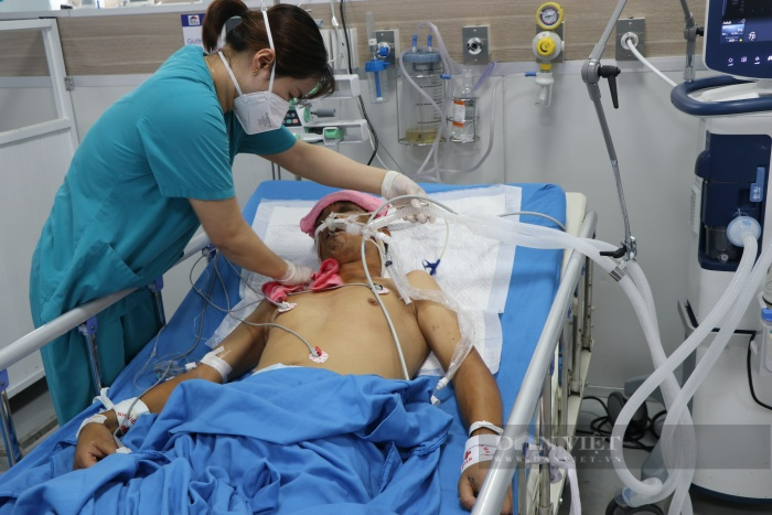 Ngày 18/4: Covid-19 tăng nhanh cả về số ca mắc và bệnh nhân nặng - Ảnh 2.