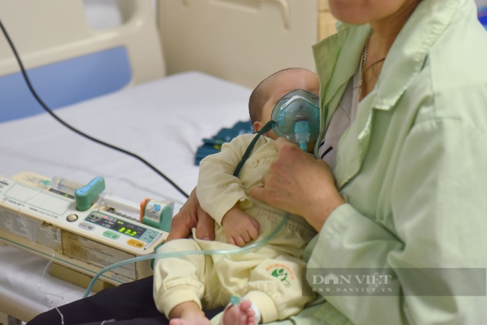 Trẻ nhập viện do nhiễm virus hợp bào hô hấp RSV tăng mạnh, bác sĩ cảnh báo khi có dấu hiệu này - Ảnh 3.