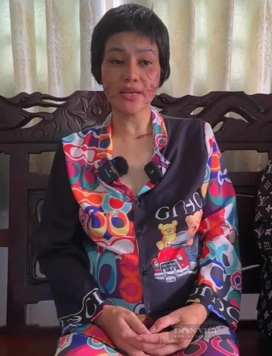 Người chồng bị vợ mang bầu 7 tháng &quot;tố&quot; bị bạo hành có 3 đời vợ, với 8 đứa con - Ảnh 2.