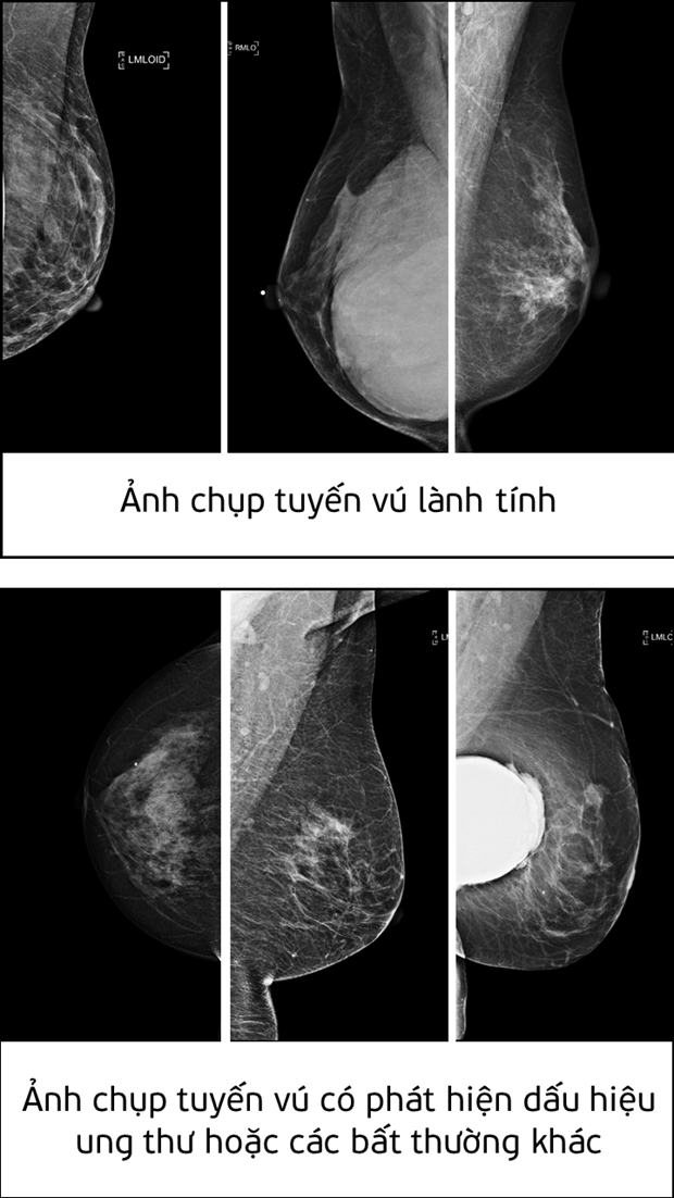 Chuyên gia AI Việt Nam giành Giải Nhất giải pháp phát hiện ung thư - Ảnh 2.