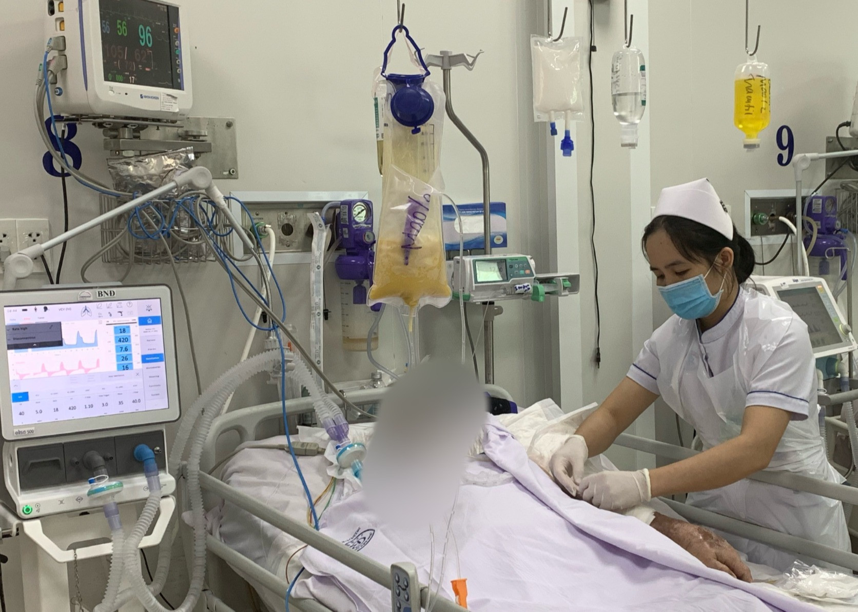 TP.HCM: Thêm 3 trường hợp ngộ độc botulinum, không còn thuốc giải - Ảnh 1.