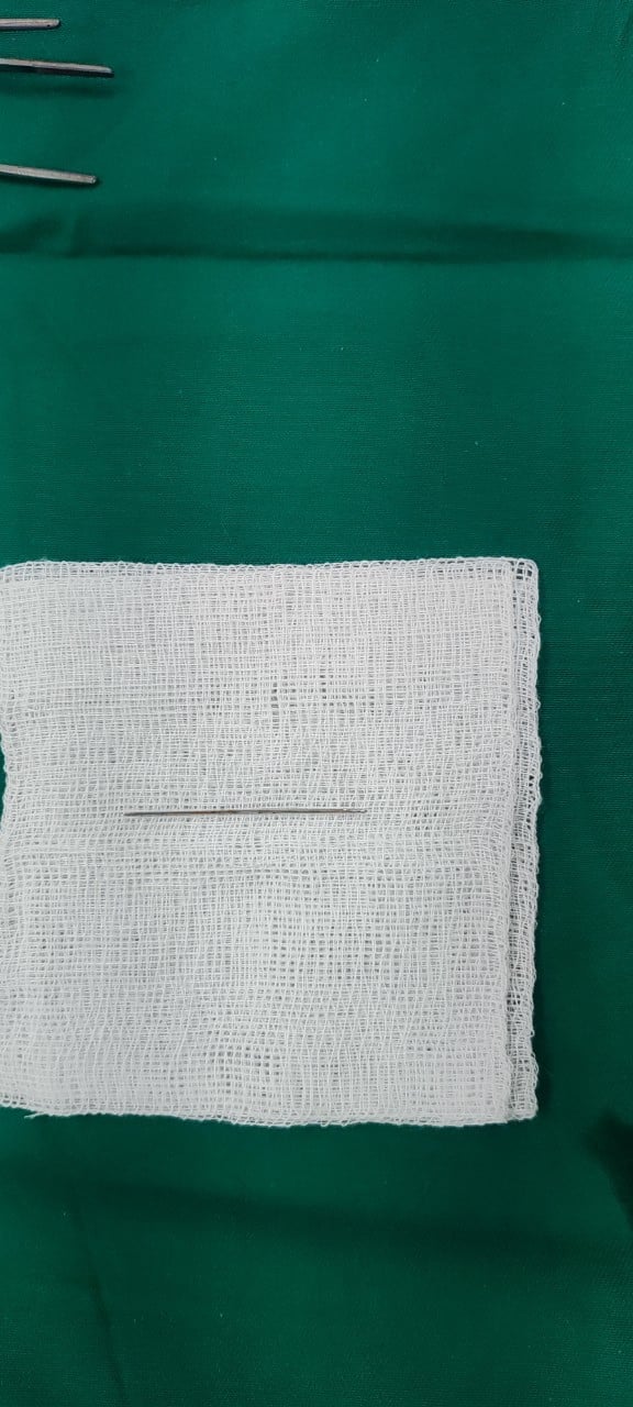 Mặc váy cưới ghim kim chuẩn bị &quot;bảo vệ&quot; chú rể trong đêm động phòng, cô dâu bị kim xuyên mông - Ảnh 2.