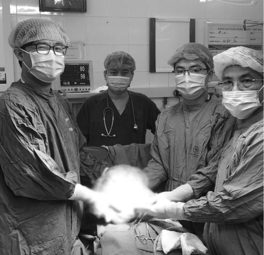 Nghĩ béo bụng, hóa ra u khổng lồ nặng gần 7kg - Ảnh 3.