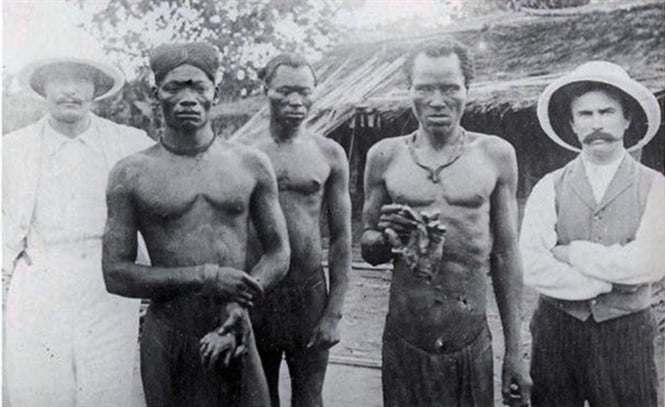 Vua Bỉ Leopold II - kẻ tàn bạo hơn trùm Phát xít Hitler - Ảnh 4.