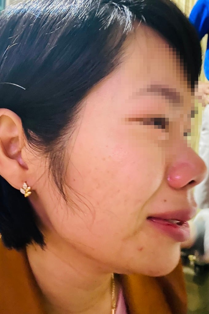 Giáo viên bị phụ huynh đánh bầm dập, hiệu trưởng nói &quot;không liên quan&quot; - Ảnh 1.