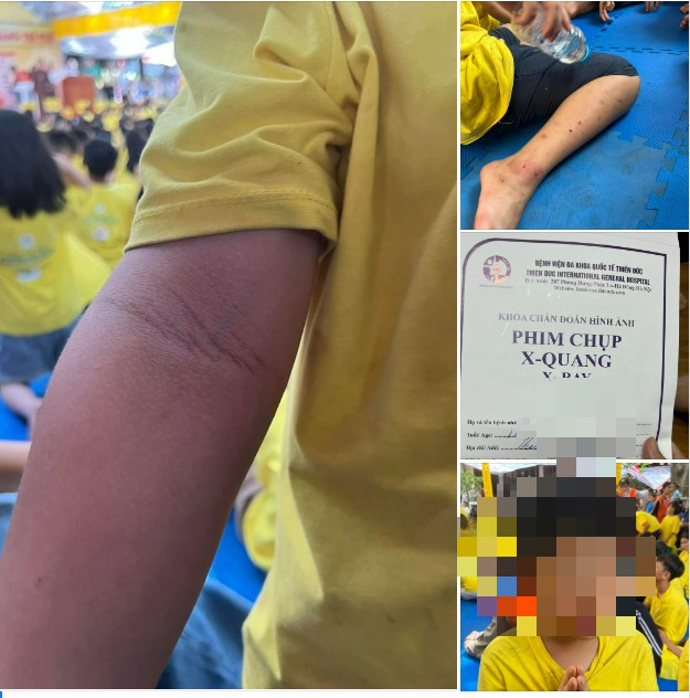 Giáo hội Phật giáo Việt Nam yêu cầu báo cáo vụ trẻ bị đánh tại khóa tu mùa hè ở chùa Cự Đà - Ảnh 3.