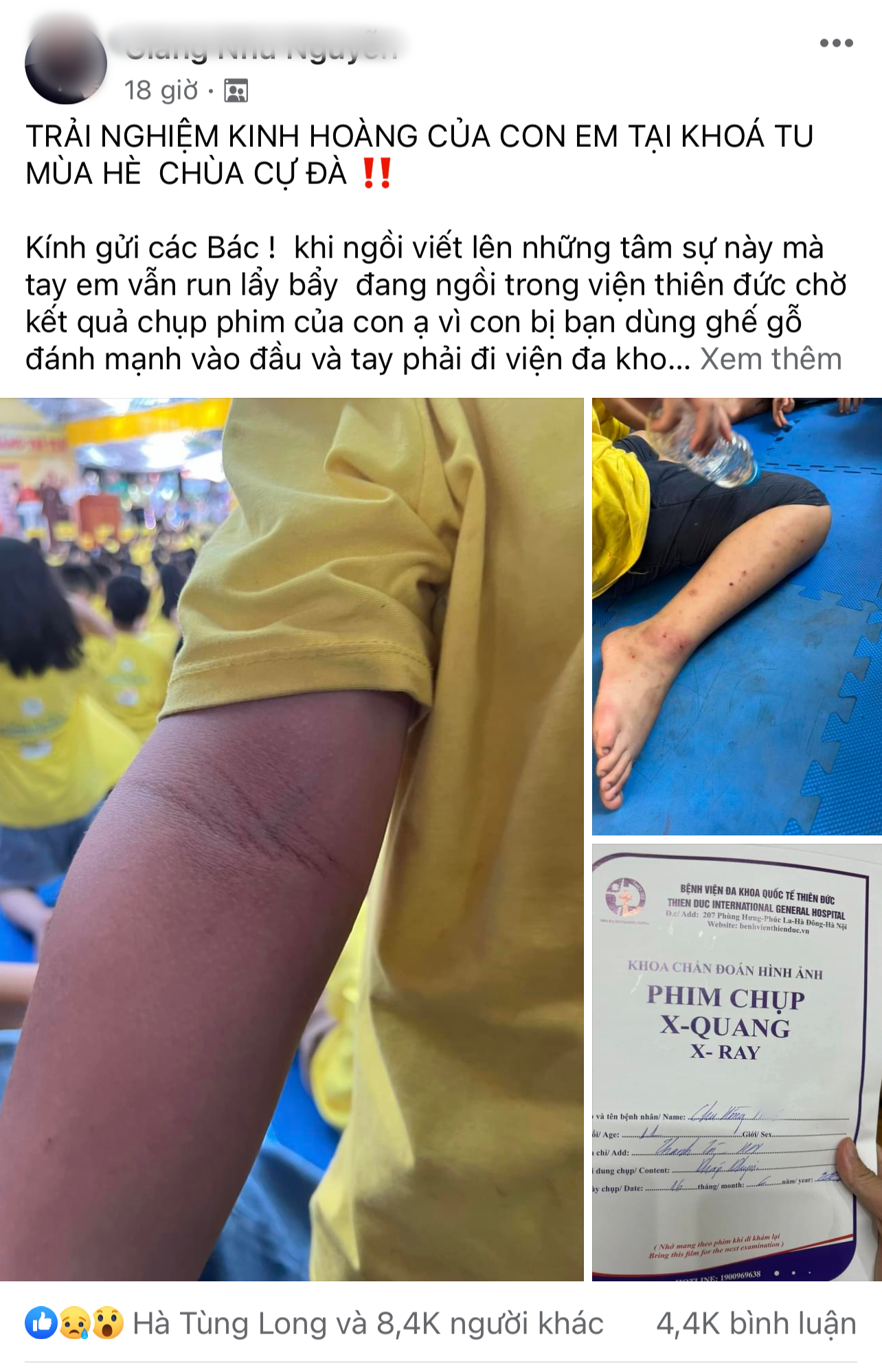 Từ vụ &quot;trải nghiệm kinh hoàng&quot; khóa tu chùa Cự Đà: Không kiểm soát dễ gây hại, mất an toàn cho trẻ - Ảnh 3.