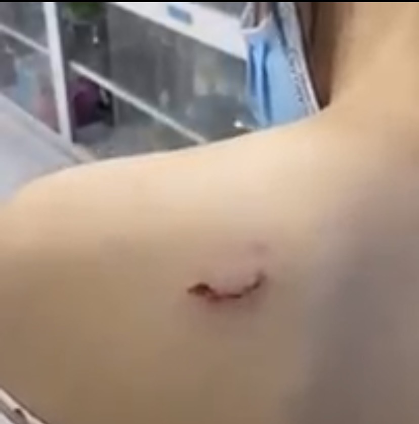 Người phụ nữ bị cướp điện thoại, ngã đập đầu xuống đường, con chó của tiệm tạp hóa lao đến cắn đại vào người - Ảnh 1.