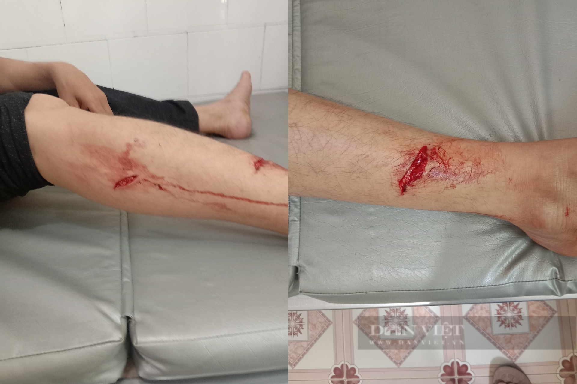 Bắc Kạn: Voọc đen má trắng quý hiếm bất ngờ tấn công người dân - Ảnh 1.