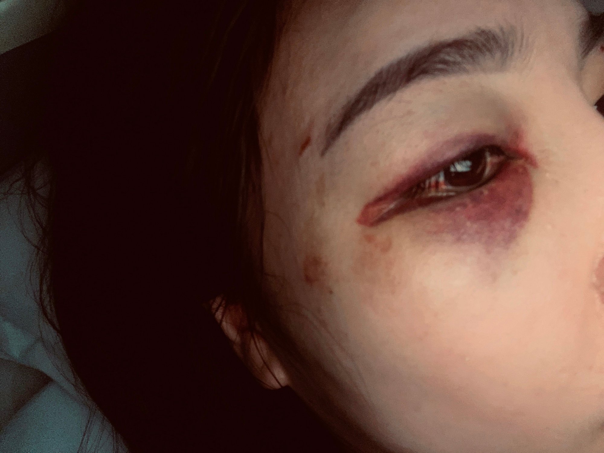 Vinh (Nghệ An): Nhóm đối tượng hành hung dã man cô gái vì nghĩ &quot;bị nhìn đểu&quot; - Ảnh 1.