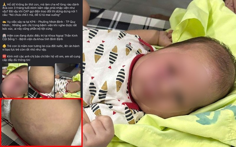 Công an đang xác minh vụ nghi cha ruột bạo hành cháu bé 3 tháng tuổi tại Bình Định- Ảnh 1.