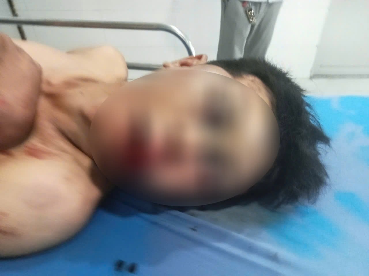 Đánh bạn nhậu bất tỉnh rồi chở đến công an trình báo- Ảnh 1.