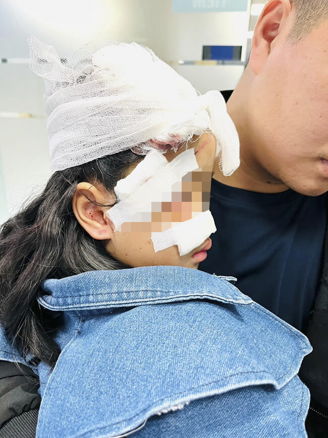 Đi chúc Tết bà ngoại, trẻ 7 tuổi bị chó cắn thủng ruột- Ảnh 2.