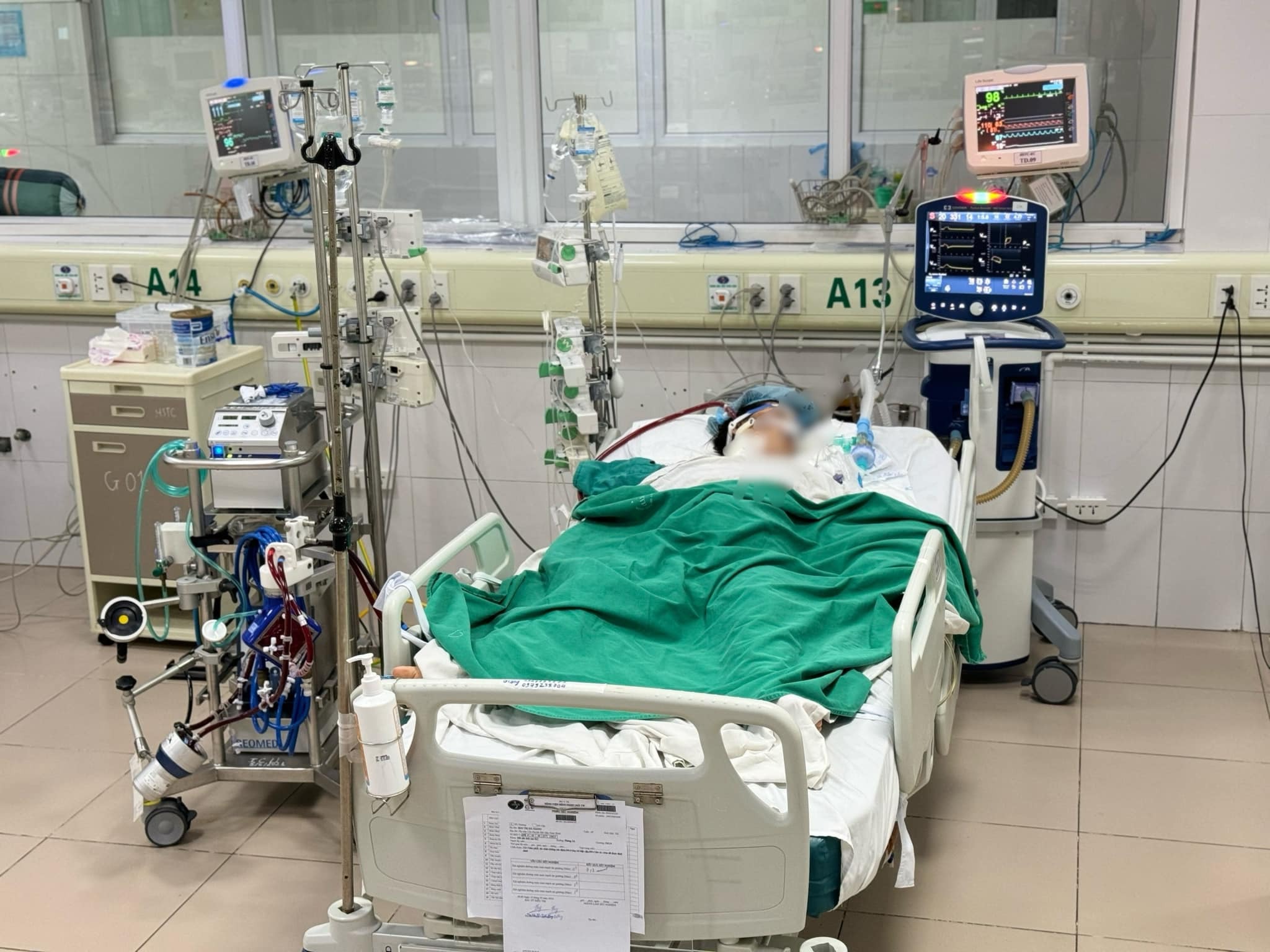 Mắc "cúm xoàng", thanh niên nhập viện trong tình trạng nguy kịch- Ảnh 2.