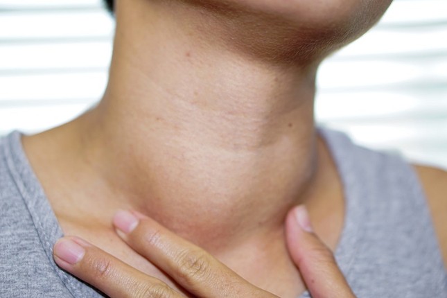 Bướu lành tính hóa ung thư vì người bệnh chủ quan- Ảnh 1.