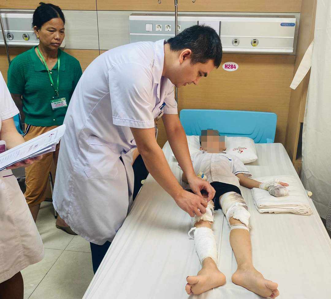 Gia tăng trẻ bị tai nạn thương tích, bác sĩ cảnh báo nguy cơ vào hè- Ảnh 2.