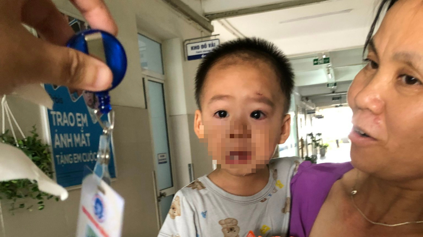 "Cứu cánh" cho những trẻ bị sụp mi bẩm sinh- Ảnh 3.