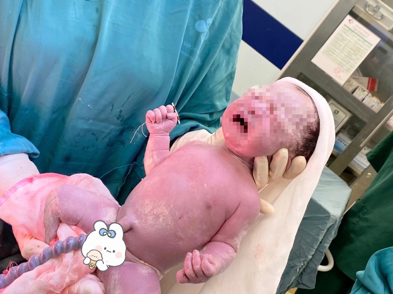 Độc lạ: Một buổi sáng có 2 bé chào đời cùng với... vòng tránh thai- Ảnh 2.