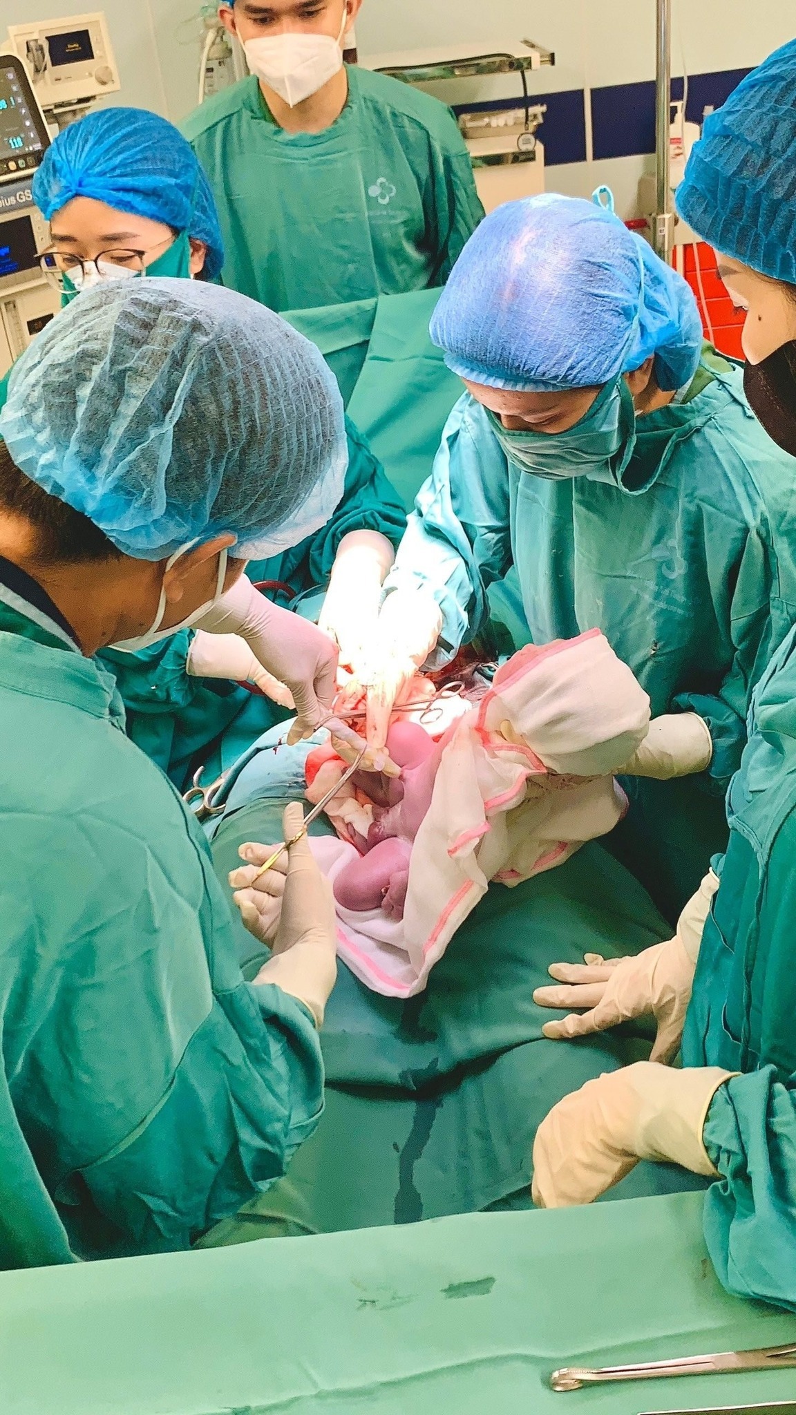 Độc lạ: Một buổi sáng có 2 bé chào đời cùng với... vòng tránh thai- Ảnh 1.