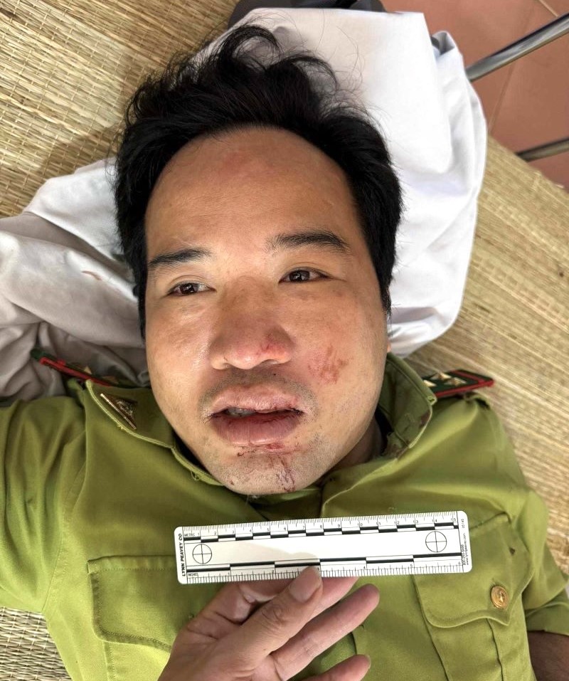 Thanh Hoá: Xe chở gỗ trái phép tông trọng thương trạm trưởng kiểm lâm- Ảnh 1.
