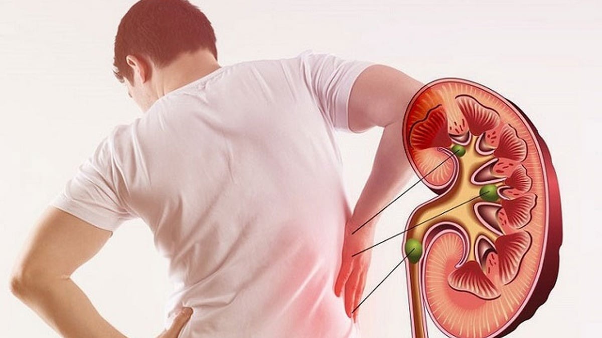 Bác sĩ Trí chia sẻ 7 dấu hiệu cảnh báo suy thận nhất định phải để ý - Ảnh 1.