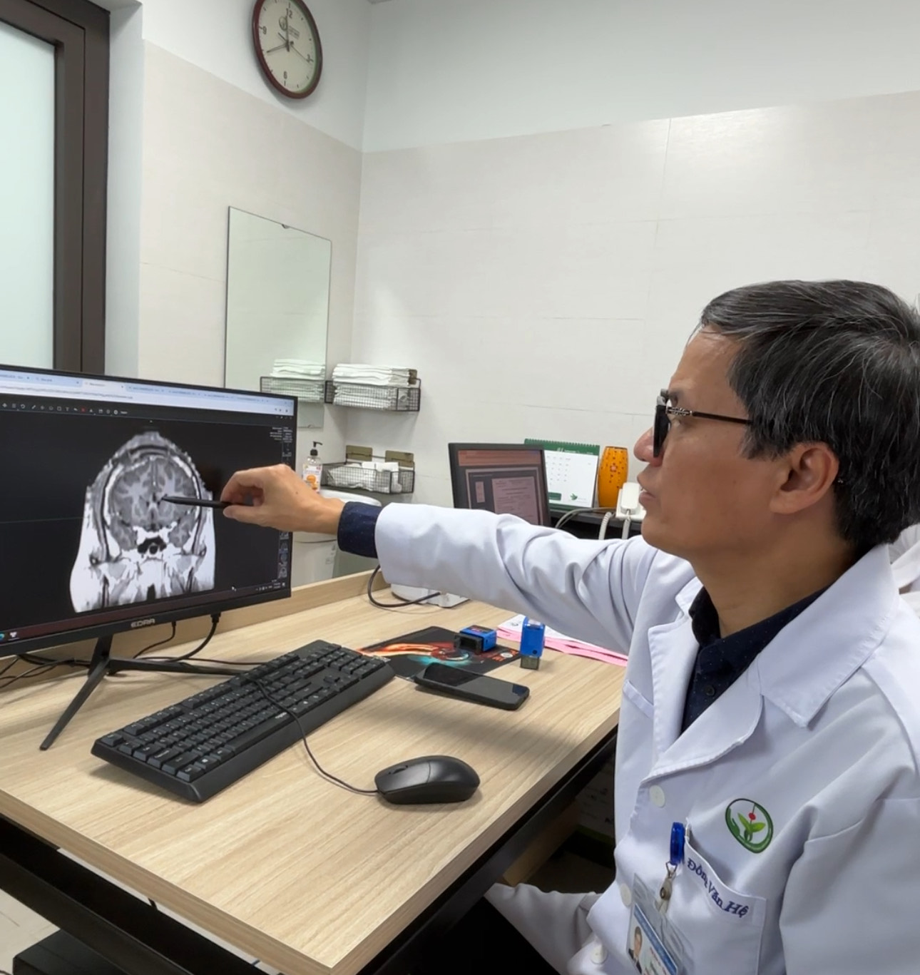 "Giải cứu" chàng trai trẻ 21 tuổi bị co giật 100 lần/ngày - Ảnh 1.