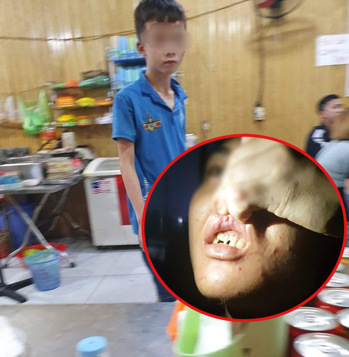 Tạm giữ một người trong vụ Những cậu bé bị hành hung, &quot;tra tấn như thời Trung cổ”! - Ảnh 1.