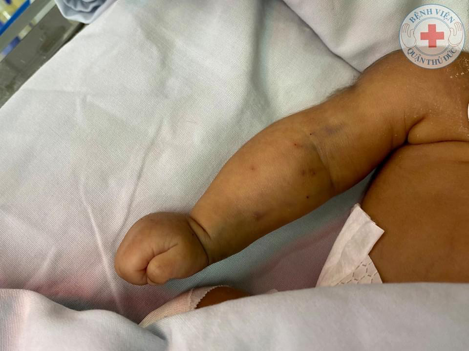 Nhói lòng bé sơ sinh nặng 1,4kg bị bỏ rơi tại chùa - Ảnh 2.