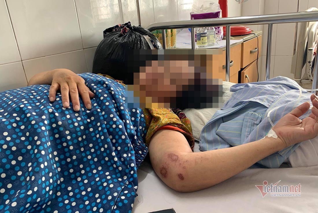 Điều tra nghi vấn chủ nợ bị cởi áo làm nhục, đánh hội đồng phải nhập viện - Ảnh 2.