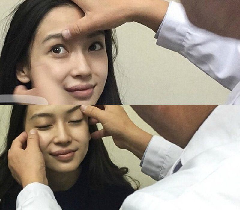 “Nữ thần thảm đỏ Trung Quốc” gây hoảng hốt bởi gương mặt biến dạng, như người ngoài hành tinh - Ảnh 3.