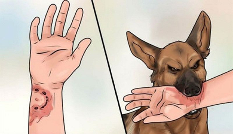 Cách phòng tránh bệnh dại khi bị chó mèo cắn - Ảnh 2.