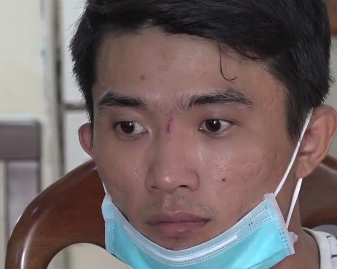 Nghi phạm sát hại, đốt xác nữ chủ quán cà phê phi tang khai gì với công an? - Ảnh 1.