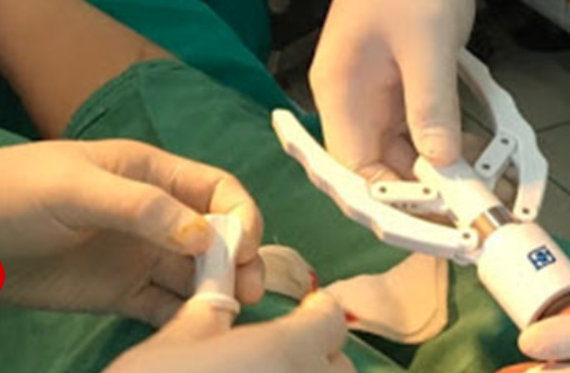 Đồng Nai: Mua máy trên mạng, tự cắt bao quy đầu một thiếu niên phải nhập viện cấp cứu - Ảnh 1.