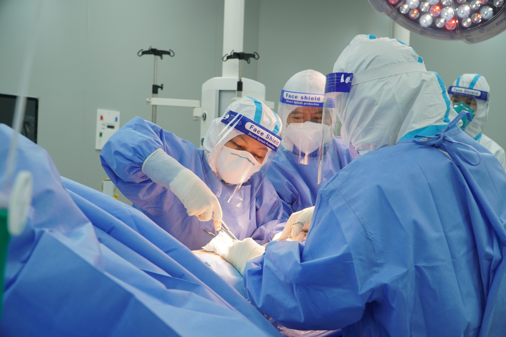Ca mổ khẩn cấp cứu sống thai nhi và sản phụ nguy kịch vì Covid-19 - Ảnh 1.