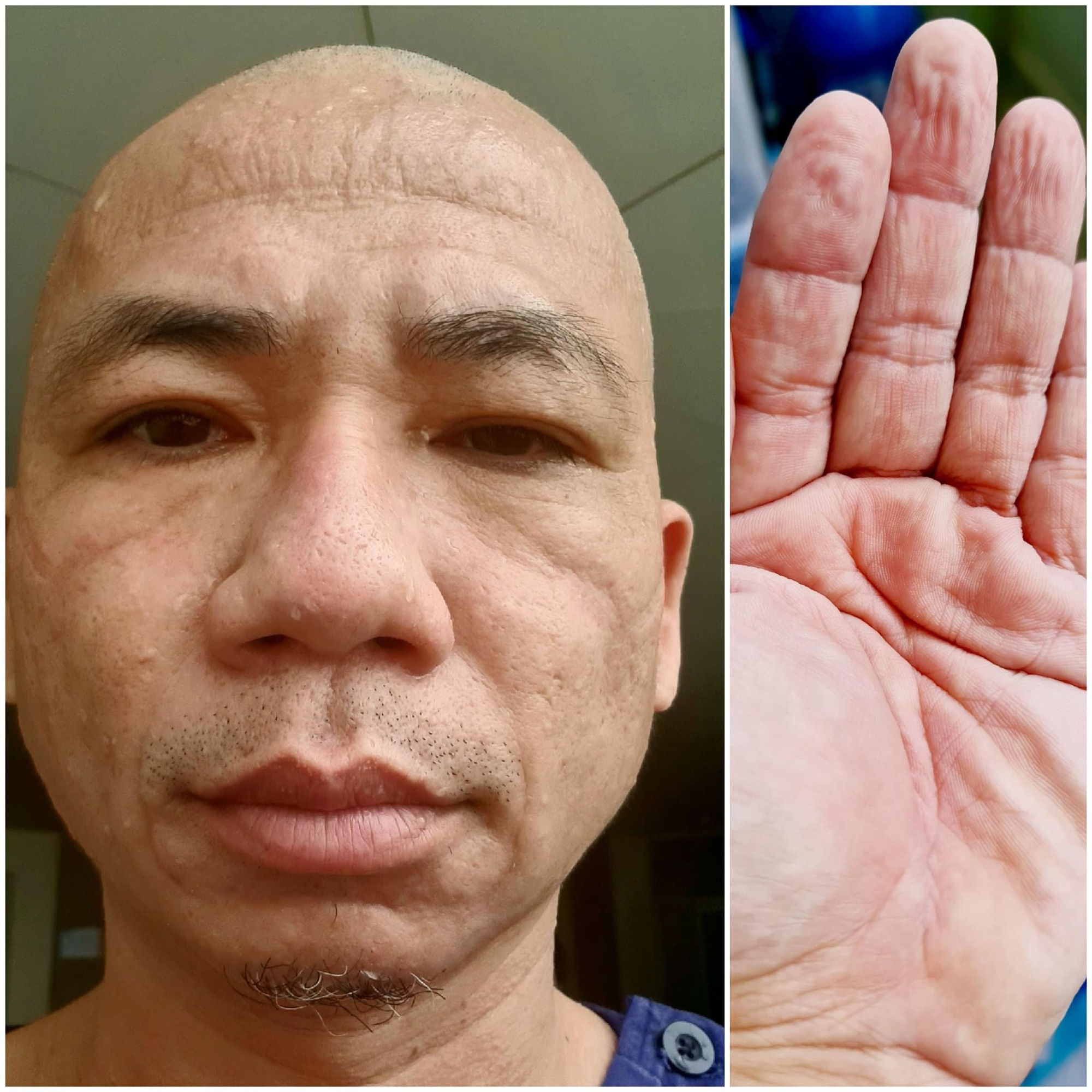 Ký ức &quot;phóng viên chiến trường&quot; giữa tâm dịch Covid-19 - Ảnh 3.