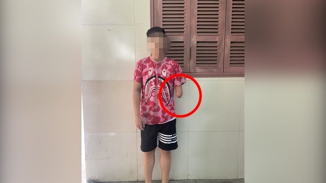 Hà Nội: &quot;Dương Quá 1 tay&quot; vẫn lái xe chở bạn vác dao đi &quot;diễu phố&quot; - Ảnh 1.