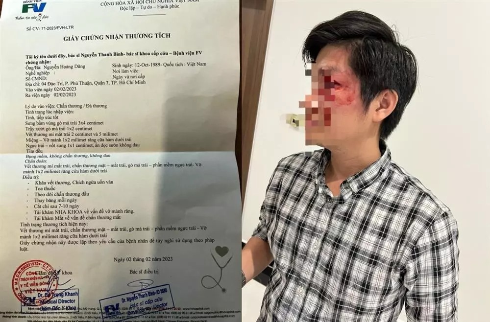 Căn cứ để khởi tố vụ người cha bị hành hung khi bảo vệ con khỏi chó không rọ mõm - Ảnh 1.