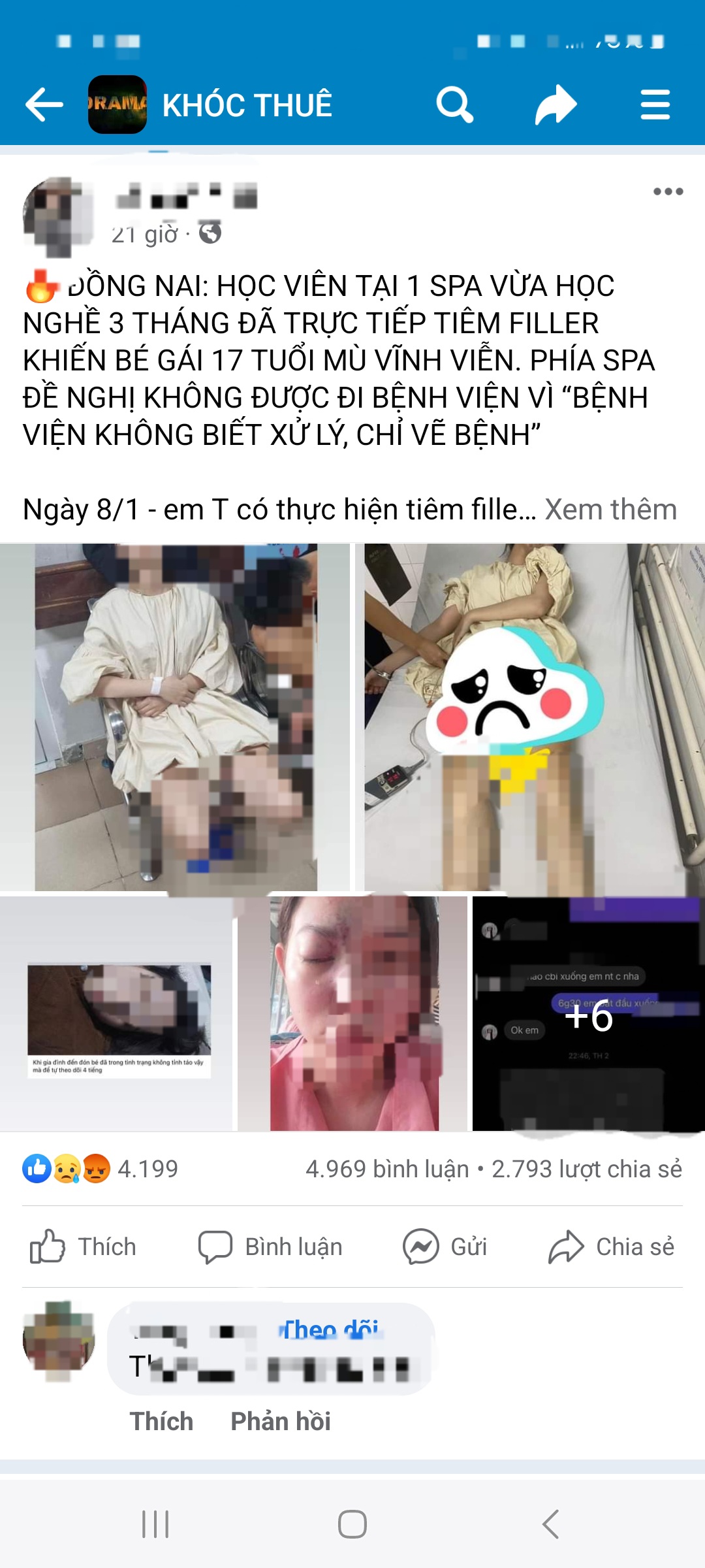 Xác minh thông tin thiếu nữ 17 tuổi mù vĩnh viễn sau khi tiêm filler tại spa ở Đồng Nai - Ảnh 2.