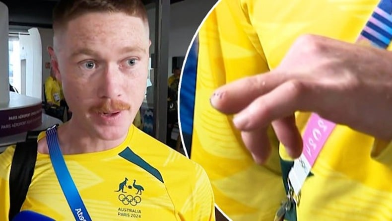 Độc lạ Olympic 2024: VĐV khúc côn cầu Australia cắt bỏ ngón tay để đến Paris- Ảnh 1.