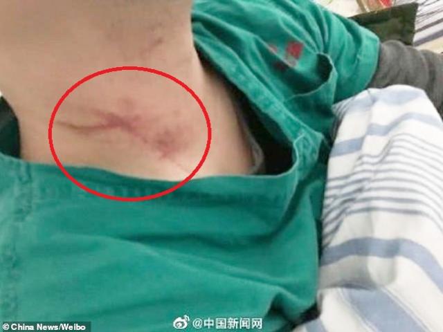 Vũ Hán: Người nhà chết do virus Corona, người đàn ông lao vào đánh, xé áo bác sĩ