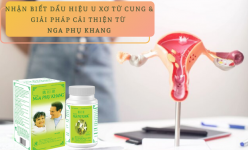 Nhận biết dấu hiệu u xơ tử cung và giải pháp cải thiện từ Nga Phụ Khang