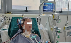 Tự dùng corticoid trị cúm, nữ bệnh nhân nguy kịch, chạy ECMO dài ngày