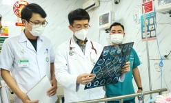 Đột quỵ não dễ tái phát, làm thế nào để phòng ngừa? 