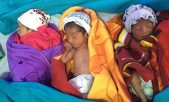 Mổ đẻ thành công ca sinh ba của một sản phụ dân tộc thiểu số