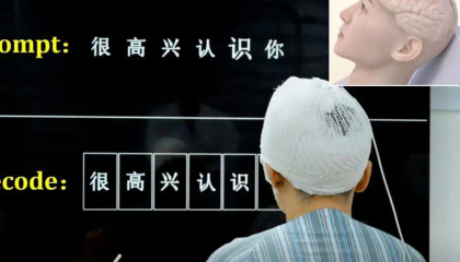 Cấy chip vào não, 'biến' suy nghĩ thành chữ
