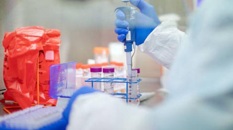 Kit thử virus corona của Abbott có thể cho kết quả dương tính chỉ sau 5 phút