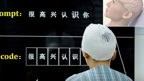 Cấy chip vào não, 'biến' suy nghĩ thành chữ