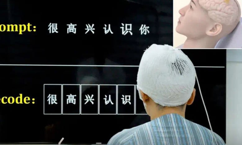 Cấy chip vào não, 'biến' suy nghĩ thành chữ